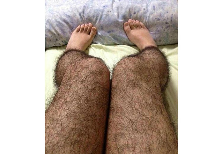 Ноги волосатых мам. Волосатык мужскиетноги. Волосатые ноги в колготках.